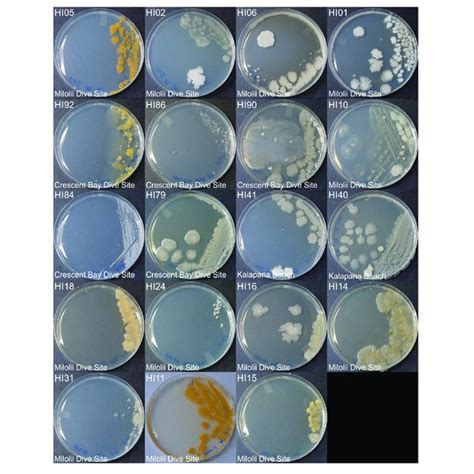 identifying colonies on agar plates